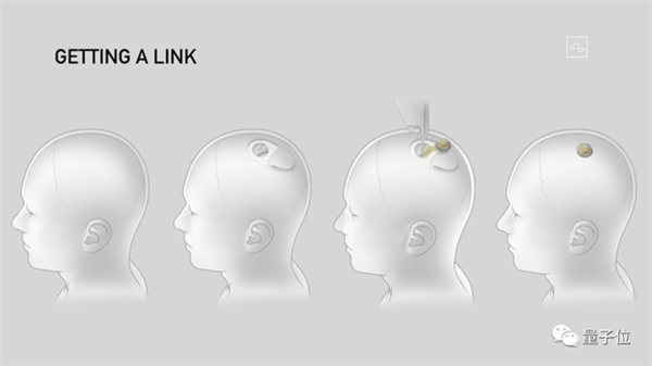 馬斯克最新芯片：腦機專用 讓失明人羣“看見”